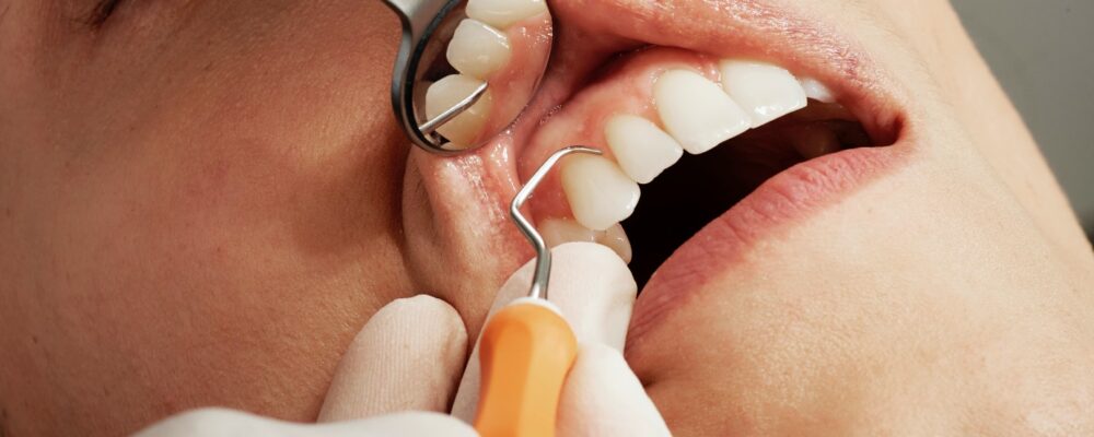 Understanding what a dental hygiene specialist is and why regular visits would be useful.